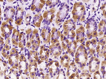 KIF14 Rabbit Polyclonal Antibody