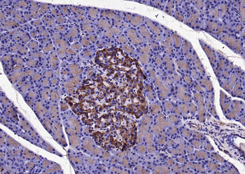 KLK1 Rabbit Polyclonal Antibody