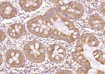 TNNI3K Rabbit Polyclonal Antibody