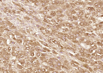 TNNI3K Rabbit Polyclonal Antibody