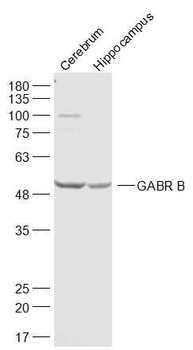 GABR B3 Rabbit Polyclonal Antibody