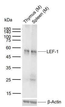 LEF-1 Rabbit Polyclonal Antibody