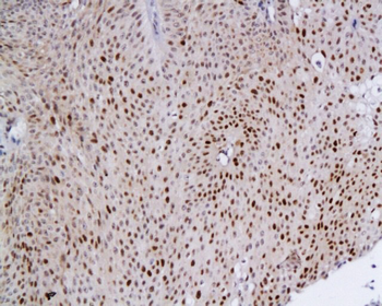 MCM2 Rabbit Polyclonal Antibody