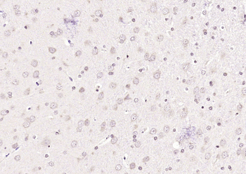 HEXIM1 Rabbit Polyclonal Antibody