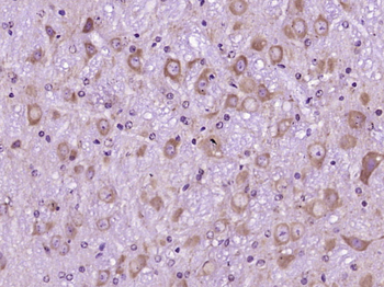 MMP17 Rabbit Polyclonal Antibody