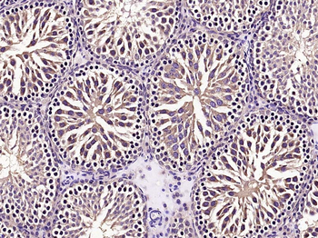 MTOR Rabbit Polyclonal Antibody