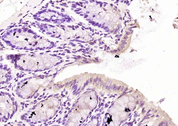 NBN Rabbit Polyclonal Antibody