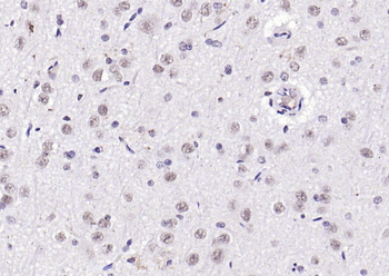 Notch3 Rabbit Polyclonal Antibody