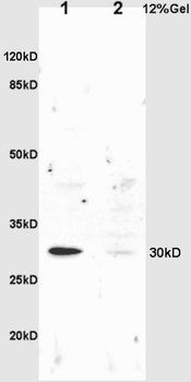 NQO1 Rabbit Polyclonal Antibody