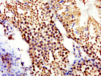 RNF16 Rabbit Polyclonal Antibody