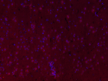 FSCN1 Rabbit Polyclonal Antibody