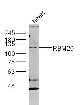 RBM20 Rabbit Polyclonal Antibody