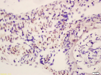 RBM20 Rabbit Polyclonal Antibody