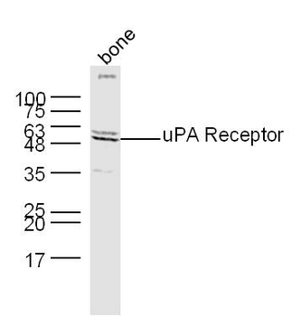 PLAUR Rabbit Polyclonal Antibody