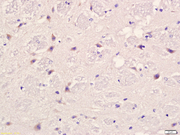 PLAUR Rabbit Polyclonal Antibody