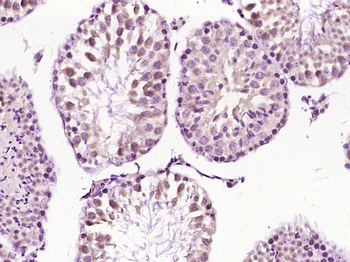 Polycystin 2 Rabbit Polyclonal Antibody