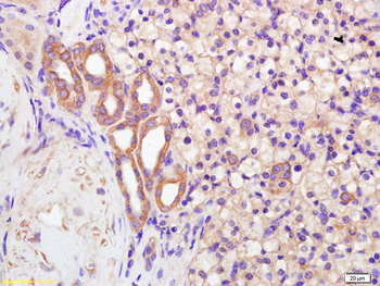 Polycystin 2 Rabbit Polyclonal Antibody