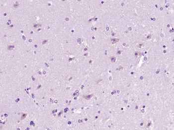 Profilin 2 Rabbit Polyclonal Antibody