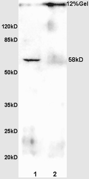 PSAP Rabbit Polyclonal Antibody