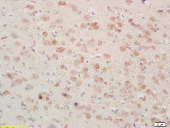 PSAP Rabbit Polyclonal Antibody