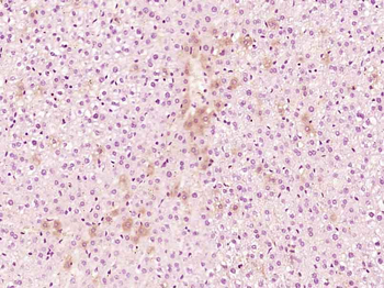 Reprimo Rabbit Polyclonal Antibody
