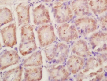 RPLP0 Rabbit Polyclonal Antibody