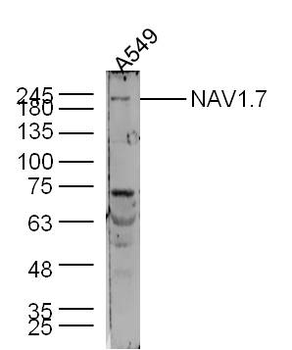 NAV1.7 Rabbit Polyclonal Antibody