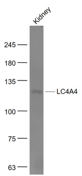 SLC4A4 Rabbit Polyclonal Antibody