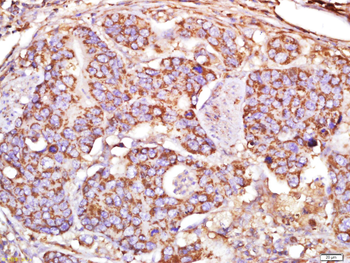 MAP1A Rabbit Polyclonal Antibody