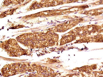 TEM1 Rabbit Polyclonal Antibody