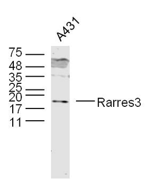 Rarres3 Rabbit Polyclonal Antibody