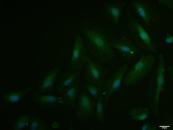 TRF2 Rabbit Polyclonal Antibody