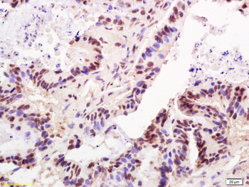 TRF2 Rabbit Polyclonal Antibody