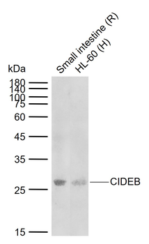 CIDEB Rabbit Polyclonal Antibody