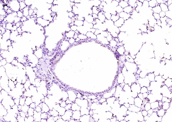 COL4A3/Tumstatin Rabbit Polyclonal Antibody