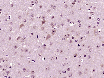 VAMP1 Rabbit Polyclonal Antibody