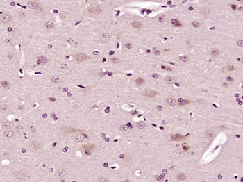 VAMP1 Rabbit Polyclonal Antibody