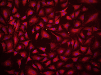 LAMP1 Rabbit Polyclonal Antibody