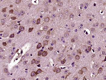 Versican Rabbit Polyclonal Antibody