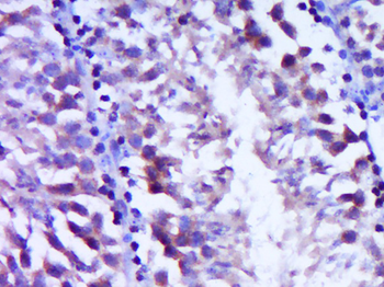 Vitronectin Rabbit Polyclonal Antibody
