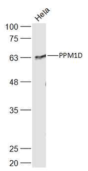 PPM1D Rabbit Polyclonal Antibody