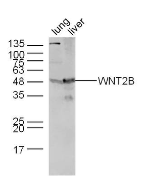 WNT2B Rabbit Polyclonal Antibody