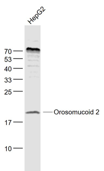 Alpha 1 acid glycoprotein 2 Rabbit Polyclonal Antibody