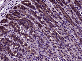 SMURF1 Rabbit Polyclonal Antibody