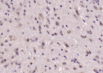 MAP7D1 Rabbit Polyclonal Antibody