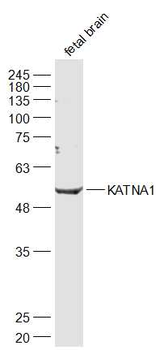KATNA1 Rabbit Polyclonal Antibody