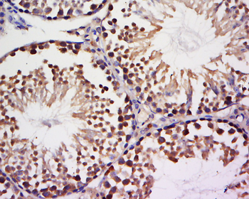 NEK9 Rabbit Polyclonal Antibody