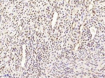 MARCH7 Rabbit Polyclonal Antibody