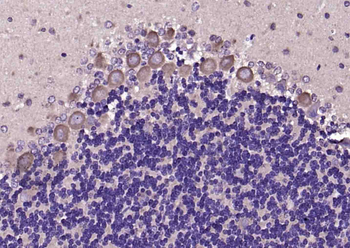 MARCH8 Rabbit Polyclonal Antibody