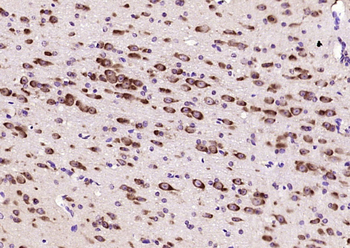 ACPL2 Rabbit Polyclonal Antibody